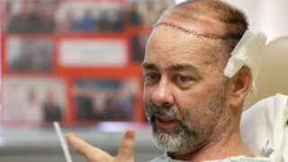 Muž dostal ženský mozek, hned se pětkrát vyboural