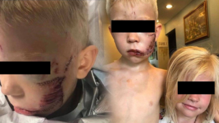 Bratr ochránil sestru za cenu zranění.