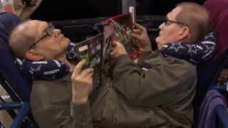 Zemřela nejdéle žijící siamská dvojčata