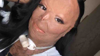 Na dívku se aktuálně pořádá sbírku