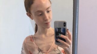 Dívka vážila neuvěřitelných 25 kilogramů