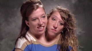 Dvojčata Abby a Brittany čekají na pravou lásku