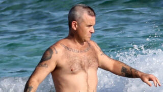 Zpěvák Robbie Williams se potýká s vypadáváním vlasů