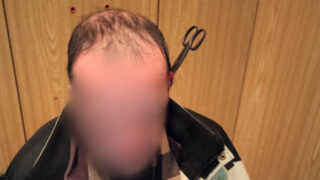 Muži vrazila partnerka nůžky do hlavy