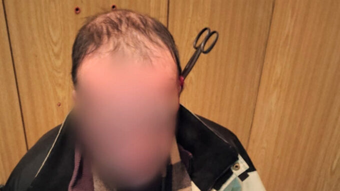 Muži vrazila partnerka nůžky do hlavy