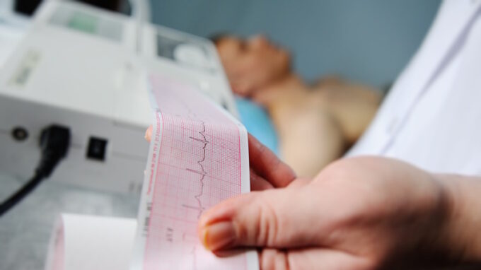 Na nemoci srdce se v ČR umírá pořád nejvíce. Lékaři volají po změně