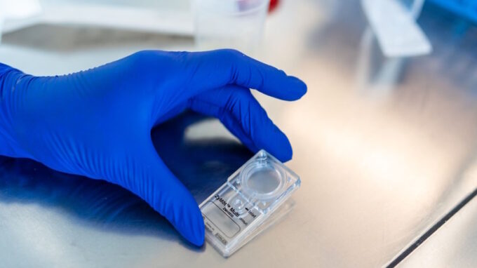 Toužíte po dítěti? ISCARE nabízí v lednu zdarma metodu mikrofluidních čipů