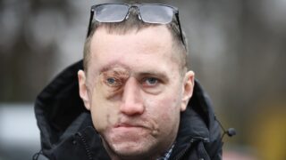 Pavel Silivončik si nechal vytetovat oko.